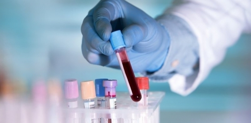 Хятадын эрдэмтэд I бүлгийн цустай хүмүүст коронавирусийн халдвар хөнгөн тусаж байгааг тогтоожээ